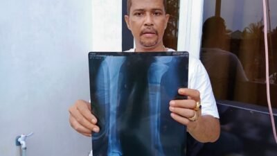 Status Penahanan Tersangka Pembacokan Dialihkan, Korban: Hukum Bisa Dibeli?